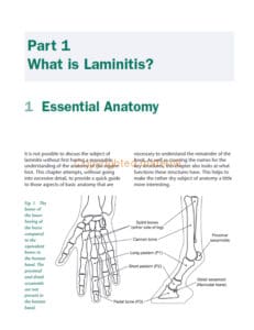 Laminitis Laminitis